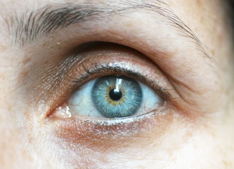 lentillas para ojo seco